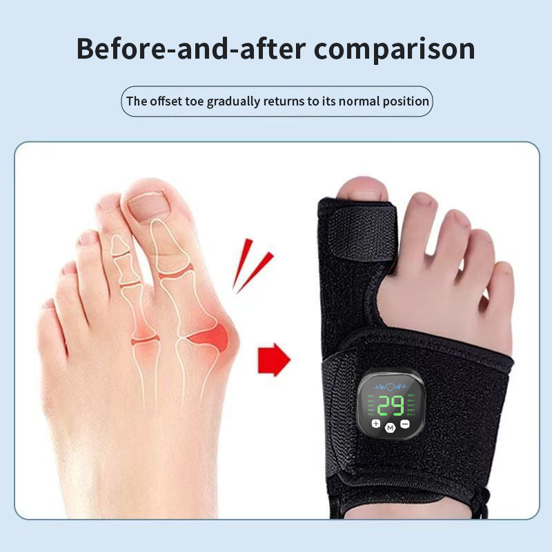 BunionAlign Pro